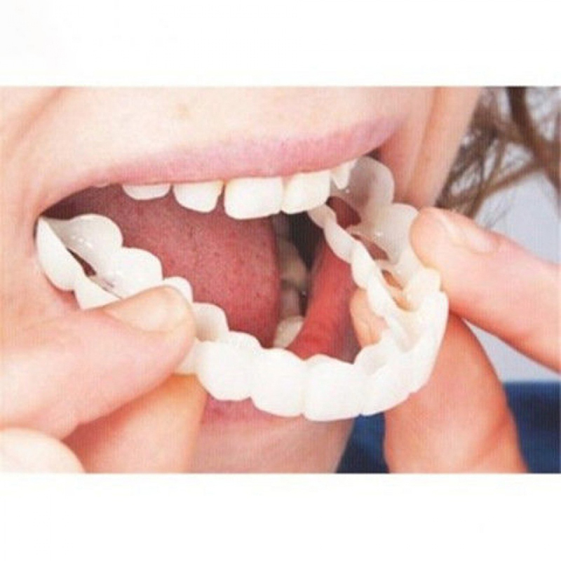 Teeth Whitening With Braces - الكمال صالح كاذبة الأسنان غطاء تبييض