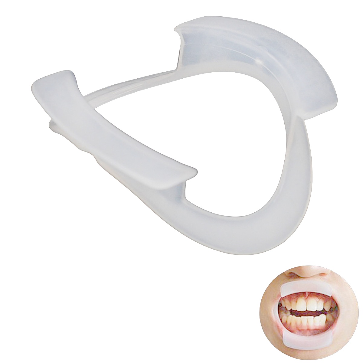 Teeth Whitening With Braces - 100 قطعة/كيس من فتاحات الفم على
