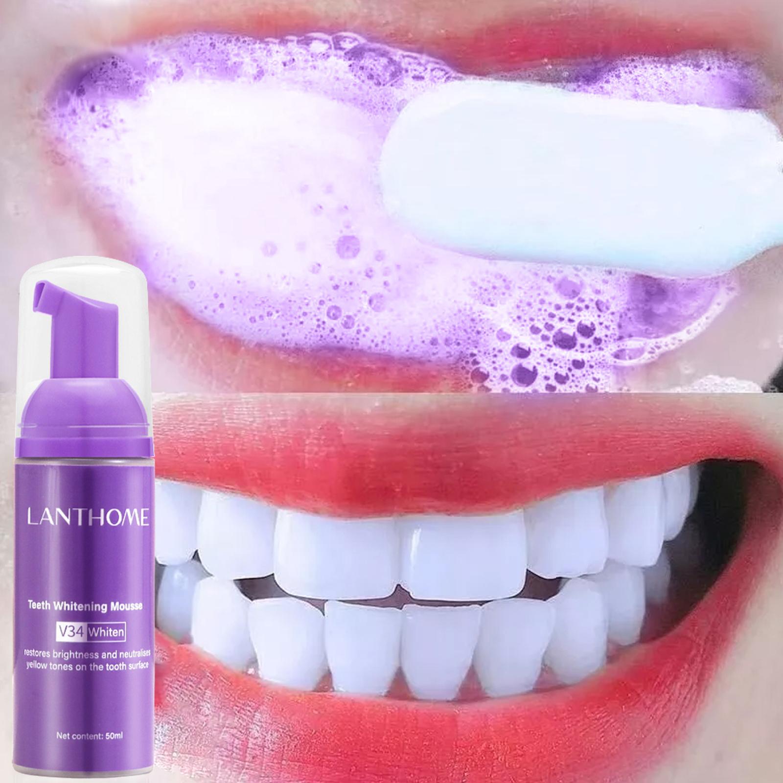 Teeth Whitening Crest - معجون أسنان V34 موس لتنظيف الأسنان،