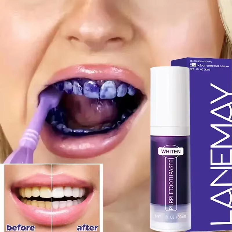 Teeth Whitening Crest - V34 معجون أسنان مبيض الأسنان الأرجواني
