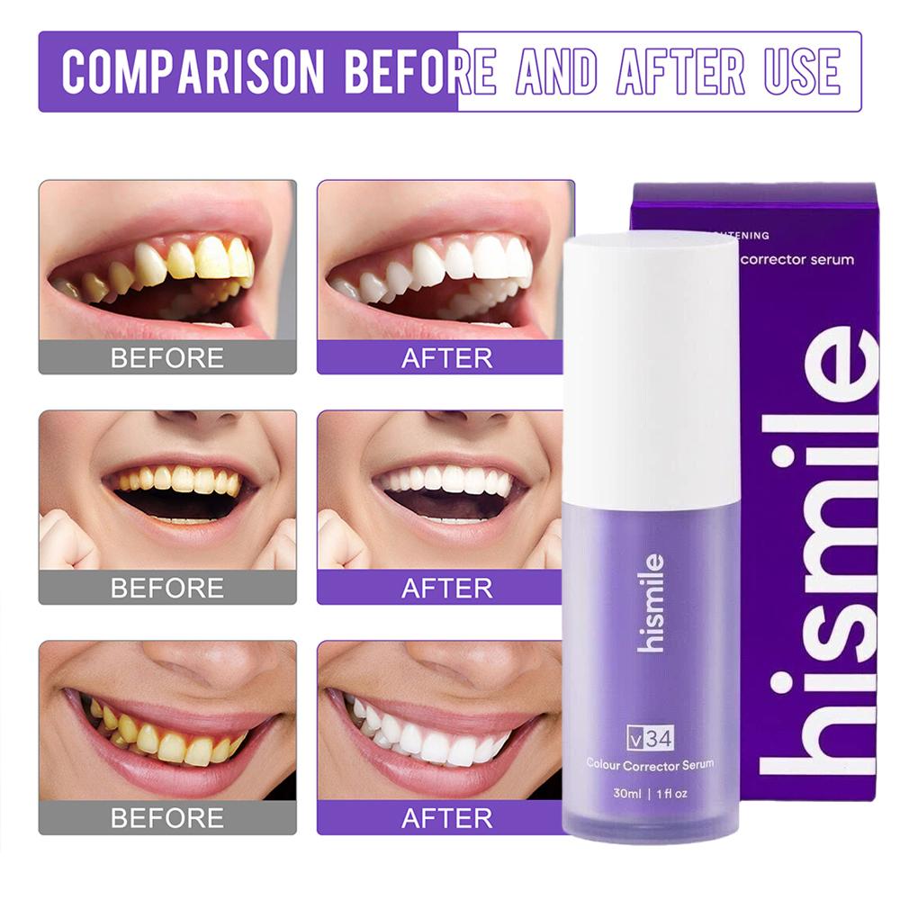 Teeth Whitening Crest - 30 مل هيسميل V34 سيروم تبييض