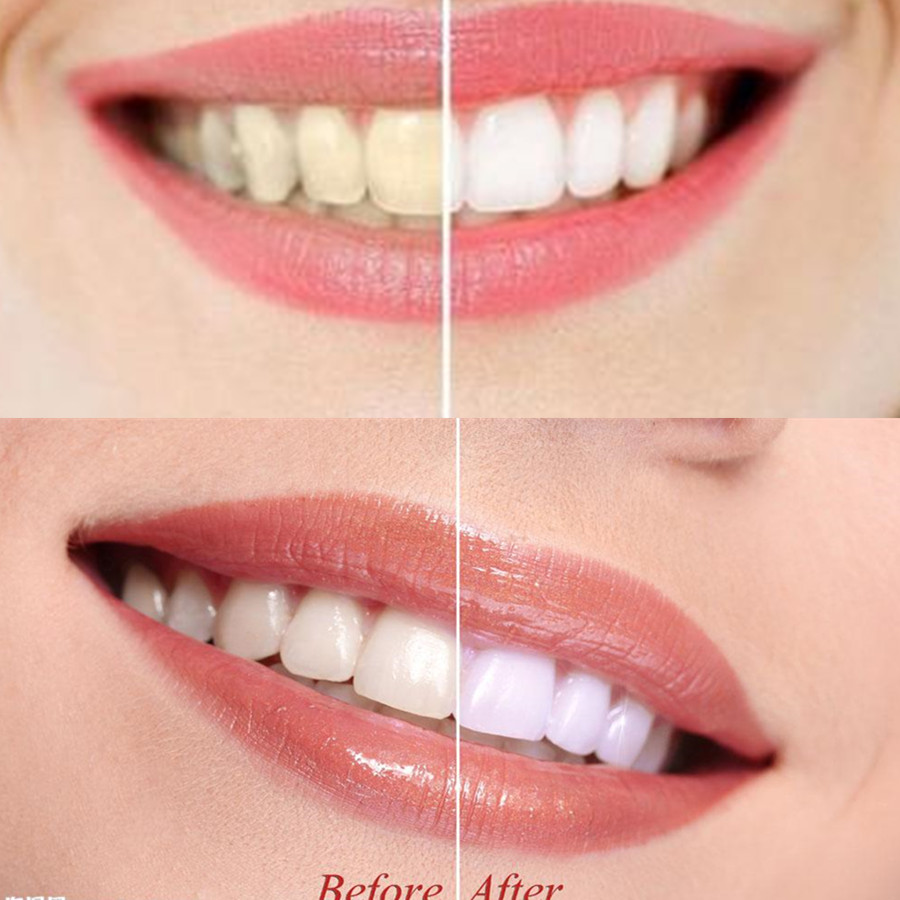 الخيزران الفحم الأسنان الأسنان - مراجعة Teeth Whitening Instant وسعره