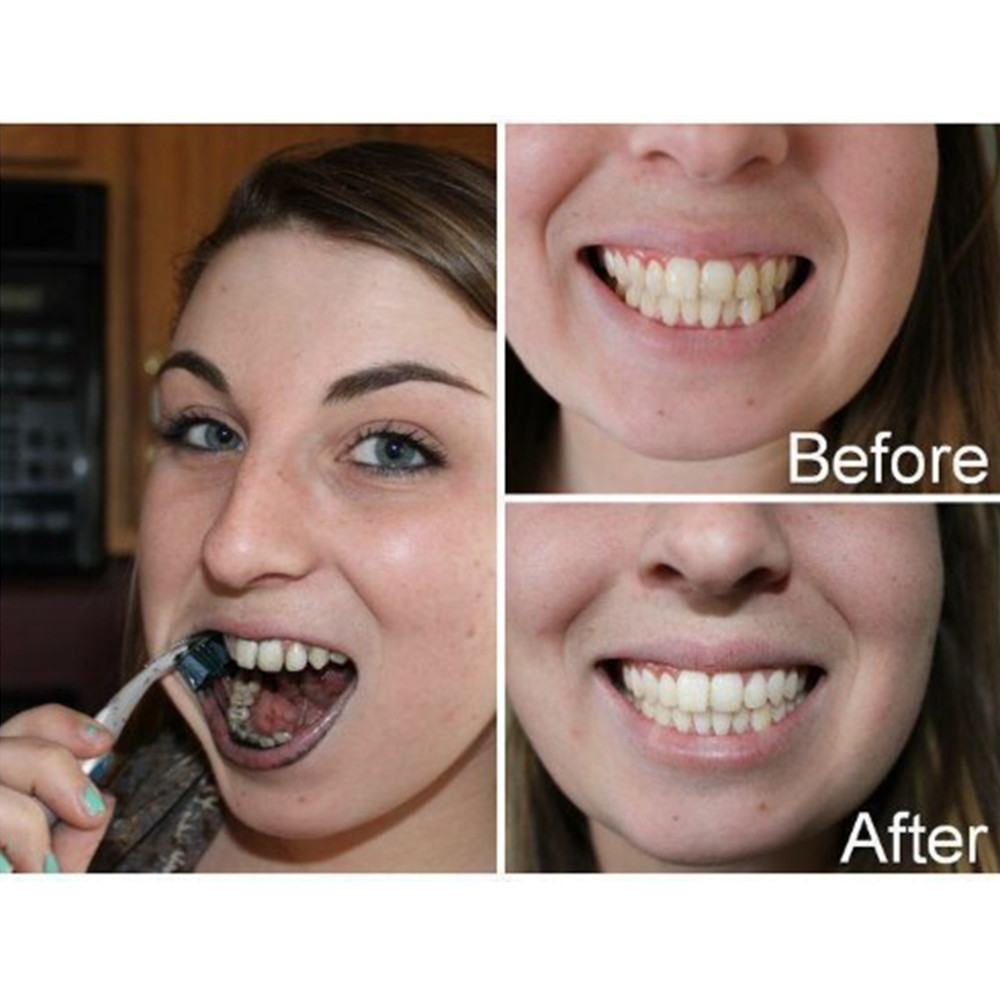 الخيزران الفحم الأسنان الأسنان - مراجعة Teeth Whitening Instant وسعره