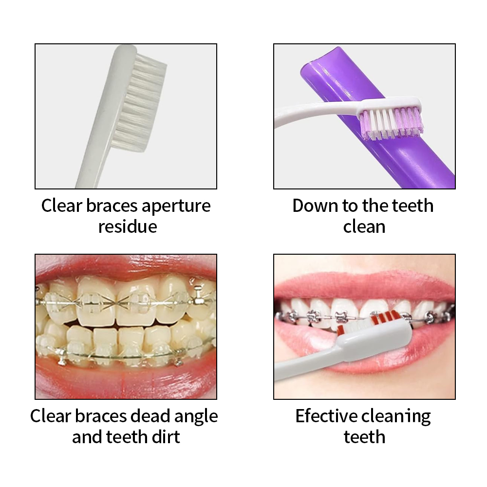 8 قطعة/المجموعة تقويم الأسنان  - مراجعة Teeth Whitening With Braces وسعره