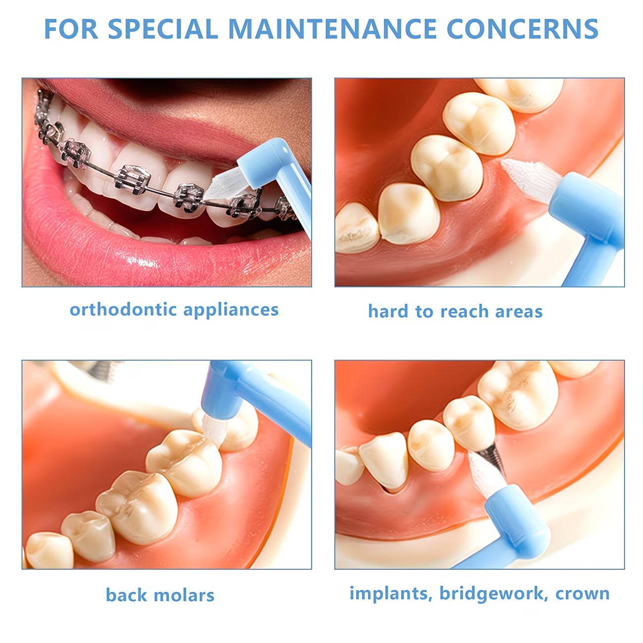 فرشاة أسنان لتقويم الأسنان برأ - مراجعة Teeth Whitening With Braces وسعره