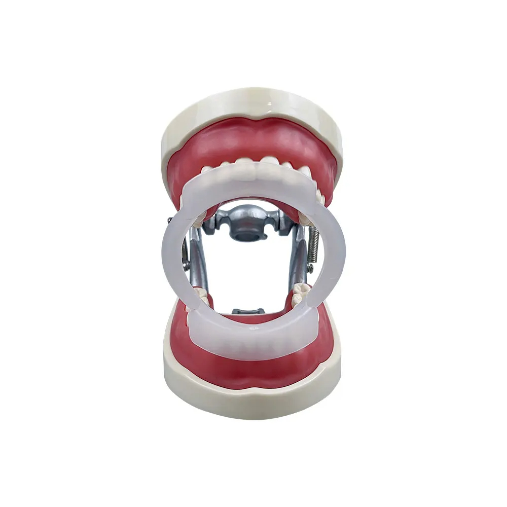 100 قطعة/كيس من فتاحات الفم عل - مراجعة Teeth Whitening With Braces وسعره