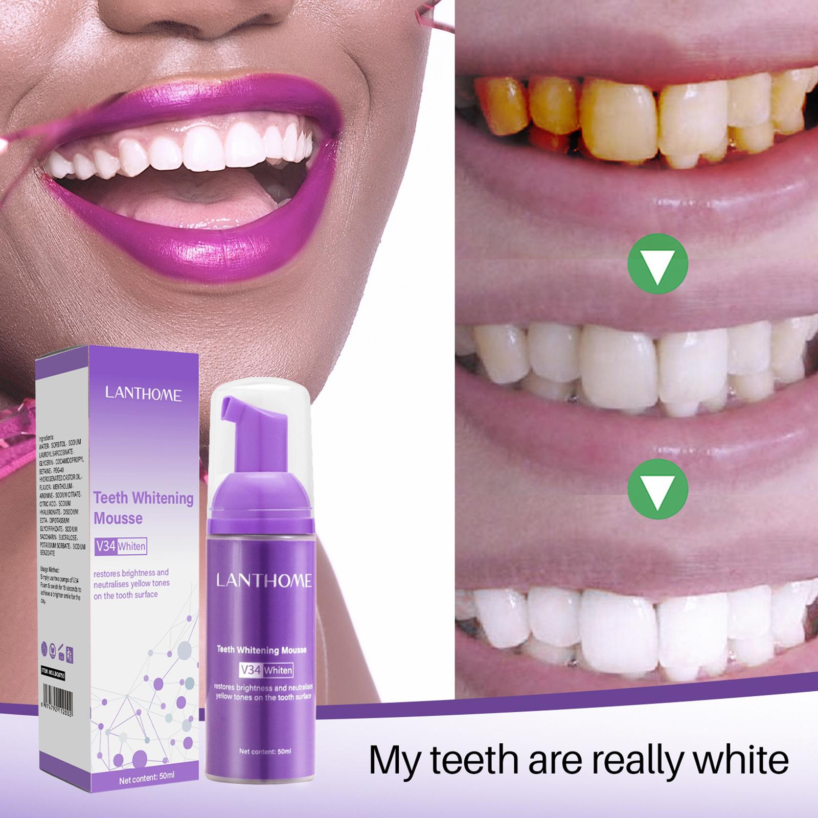 معجون أسنان V34 موس لتنظيف الأ - مراجعة Teeth Whitening Crest وسعره