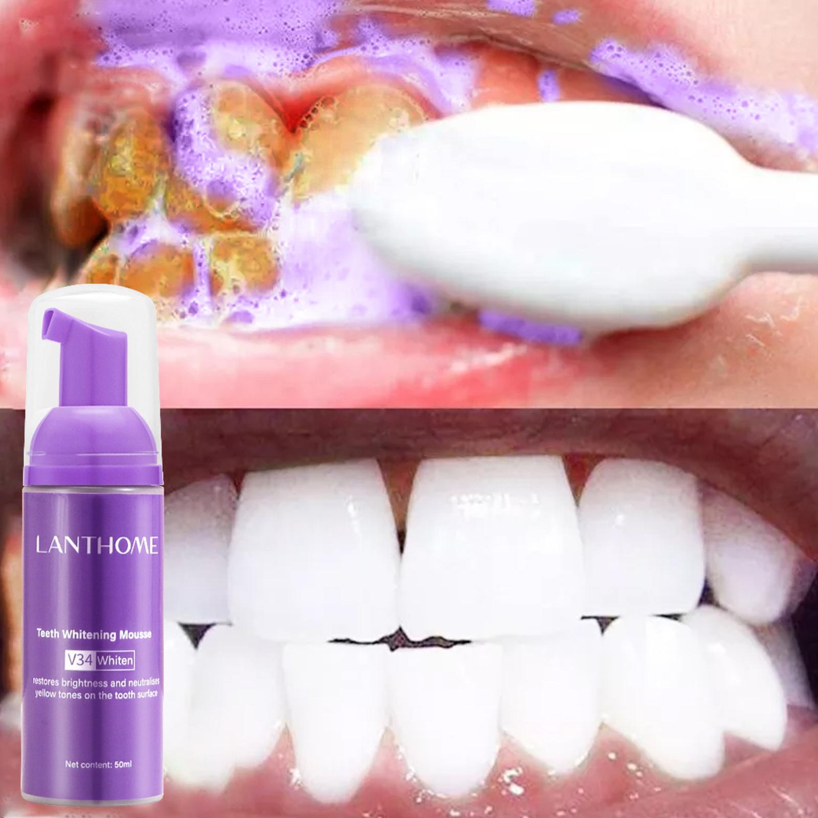 معجون أسنان V34 موس لتنظيف الأ - مراجعة Teeth Whitening Crest وسعره