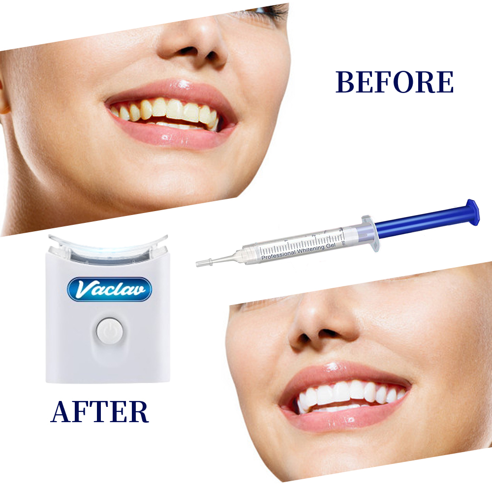 النعناع تبييض الأسنان جل حقنة  - مراجعة Teeth Whitening Kit At Home وسعره