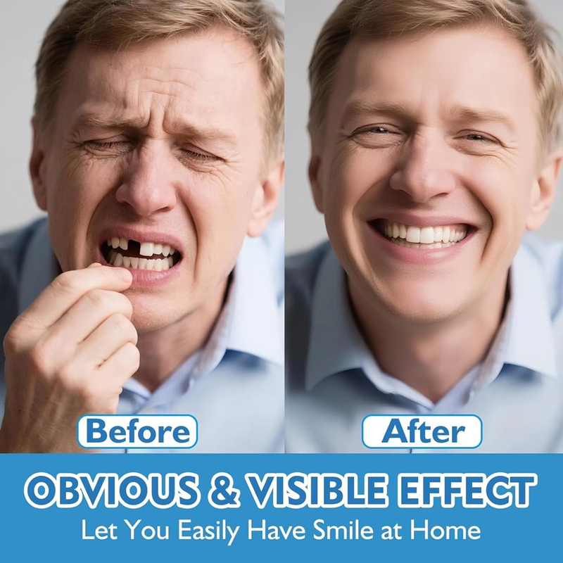 طقم كامل من أطقم الأسنان السيل - مراجعة Teeth Whitening Instant وسعره