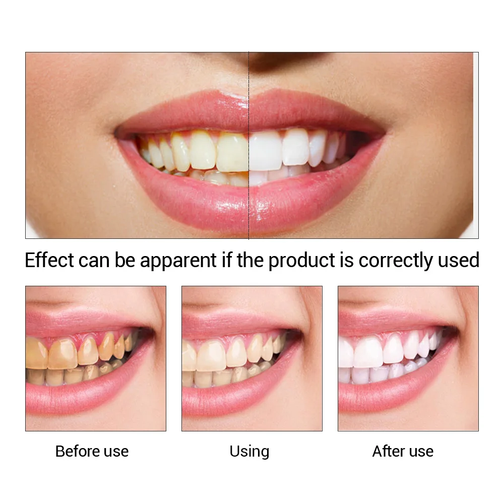 Fteenly تبييض الأسنان جوهر مسح - مراجعة Teeth Whitening Instant وسعره