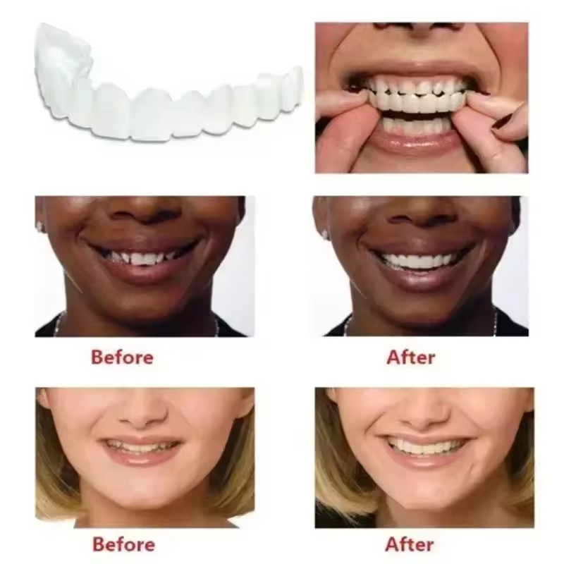 أطقم أسنان اصطناعية مؤقتة لتبي - مراجعة Teeth Whitening With Braces وسعره