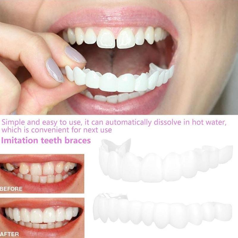المفاجئة على قشور الأسنان سيلي - مراجعة Teeth Whitening Instant وسعره