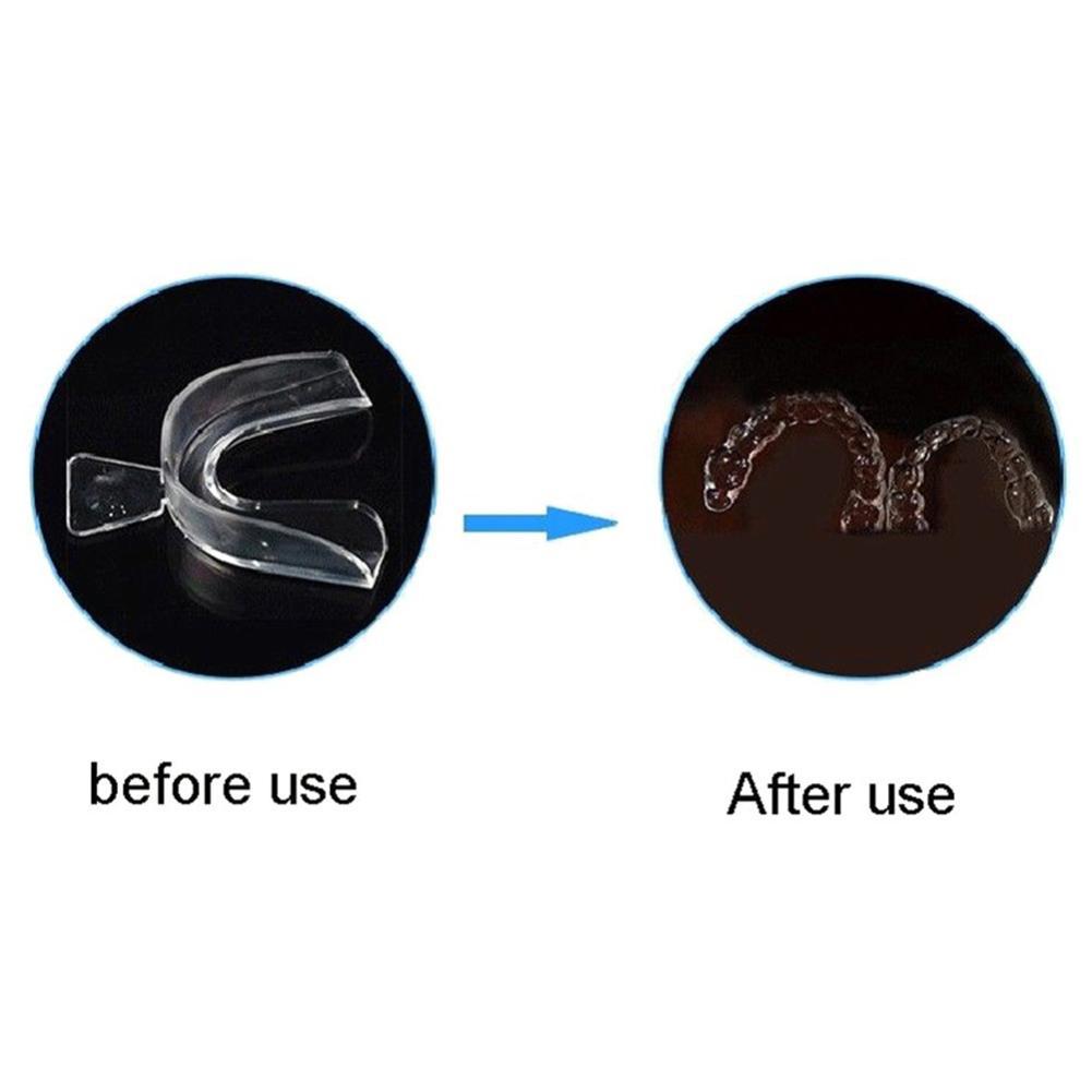 واقي فم سيليكون لتقويم الأسنان - مراجعة Teeth Whitening With Braces وسعره