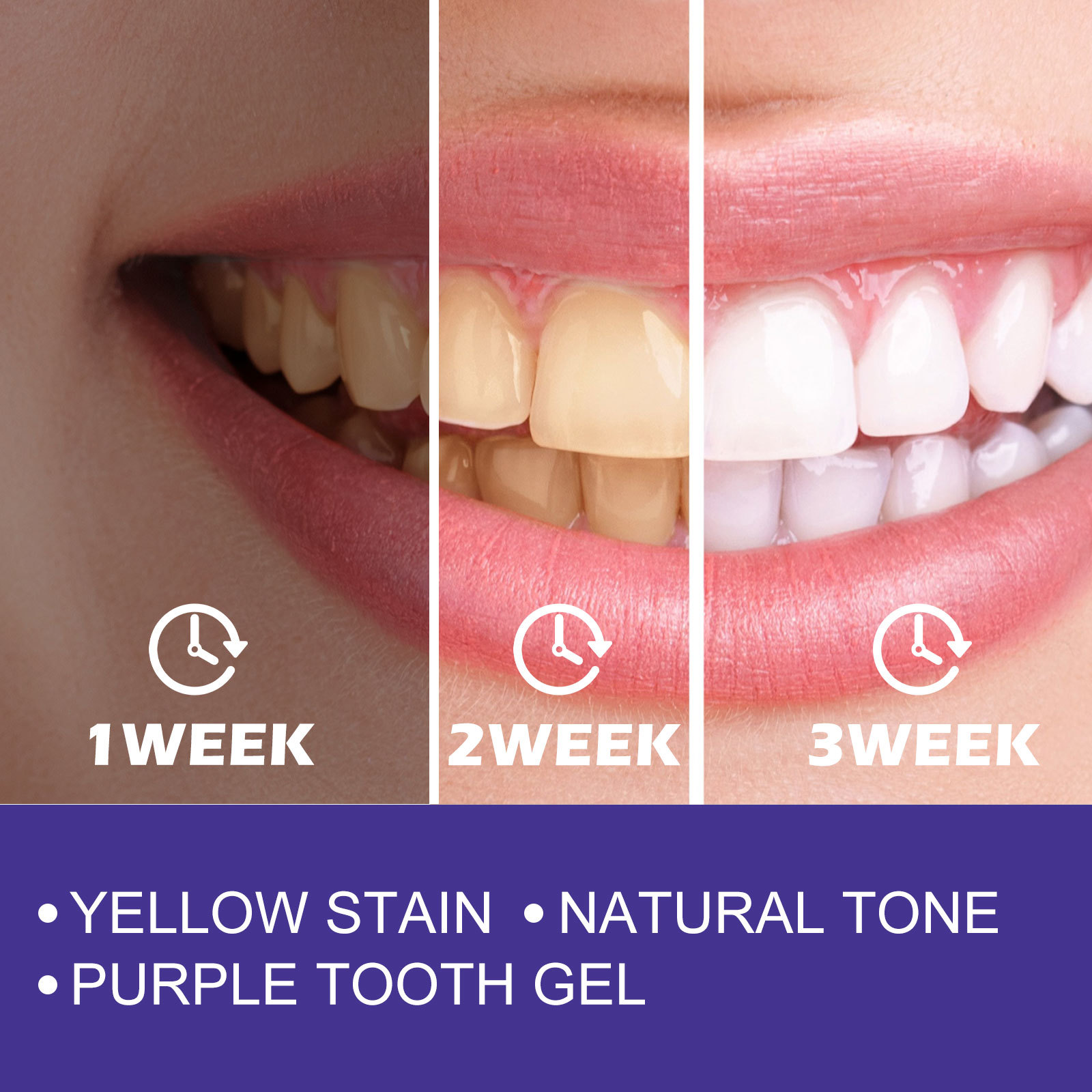 معجون أسنان أرجواني لتبييض الأ - مراجعة Teeth Whitening Crest وسعره