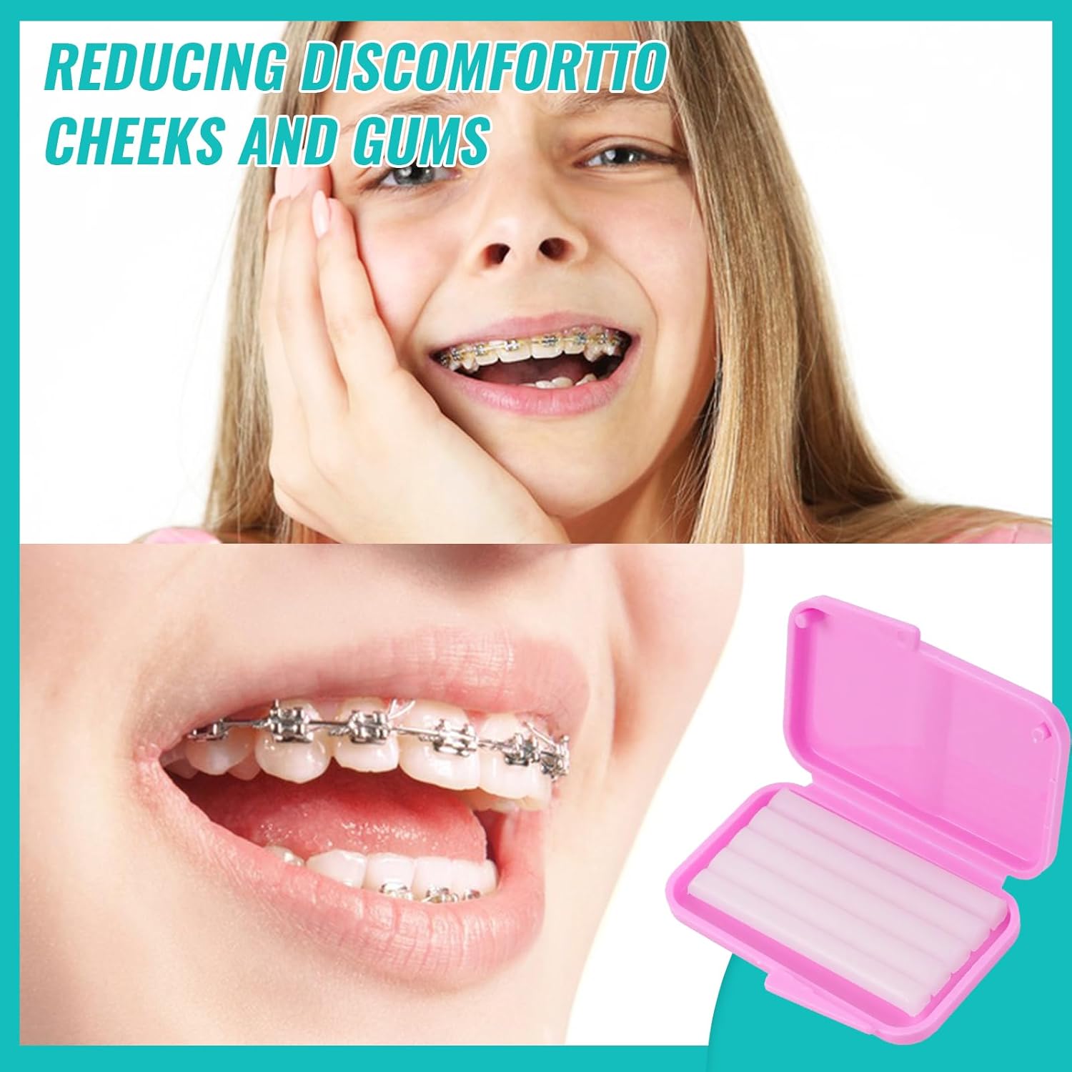 10 صندوق شمع لتقويم الأسنان لت - مراجعة Teeth Whitening With Braces وسعره