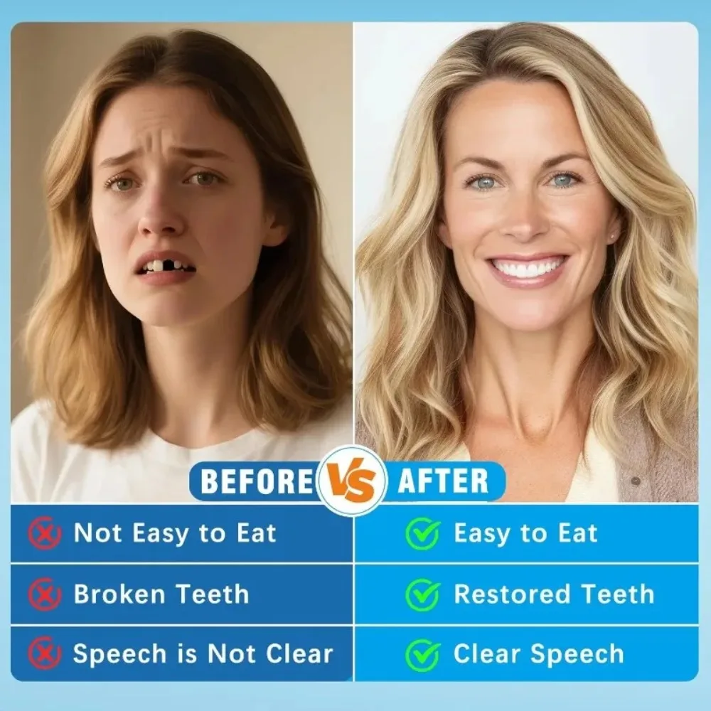 طقم كامل من أطقم الأسنان الاصط - مراجعة Teeth Whitening Instant وسعره