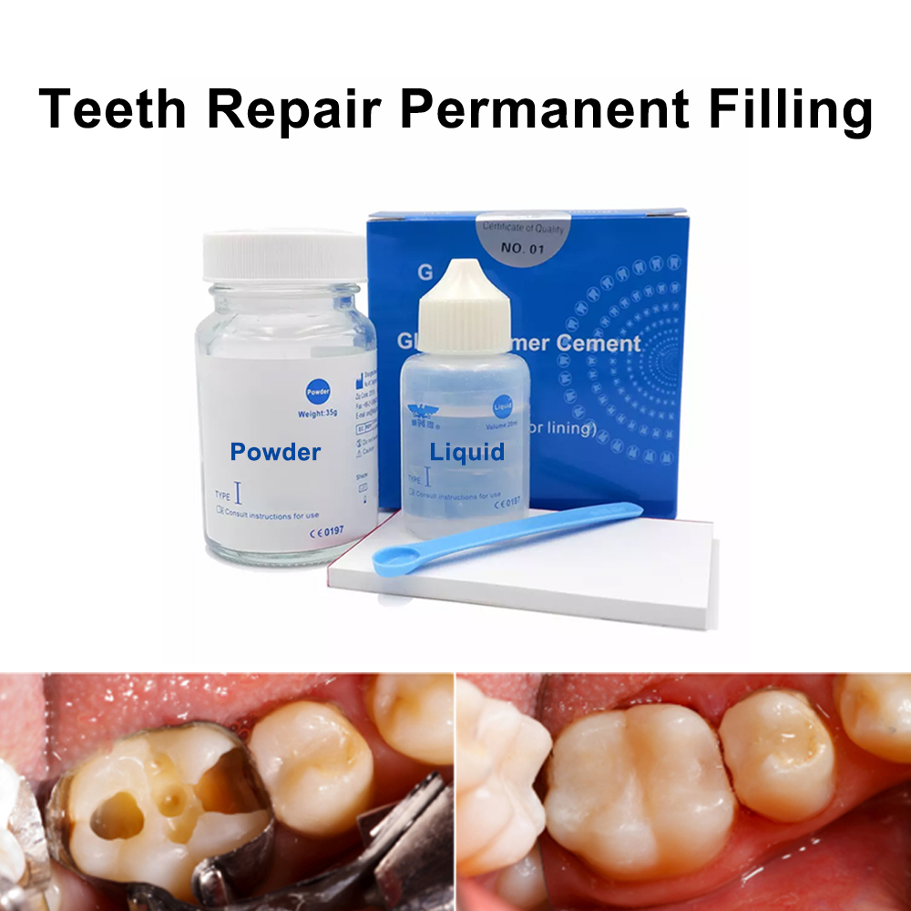 دائم الأسنان ملء طقم إصلاح في  - مراجعة Teeth Whitening Kit At Home وسعره