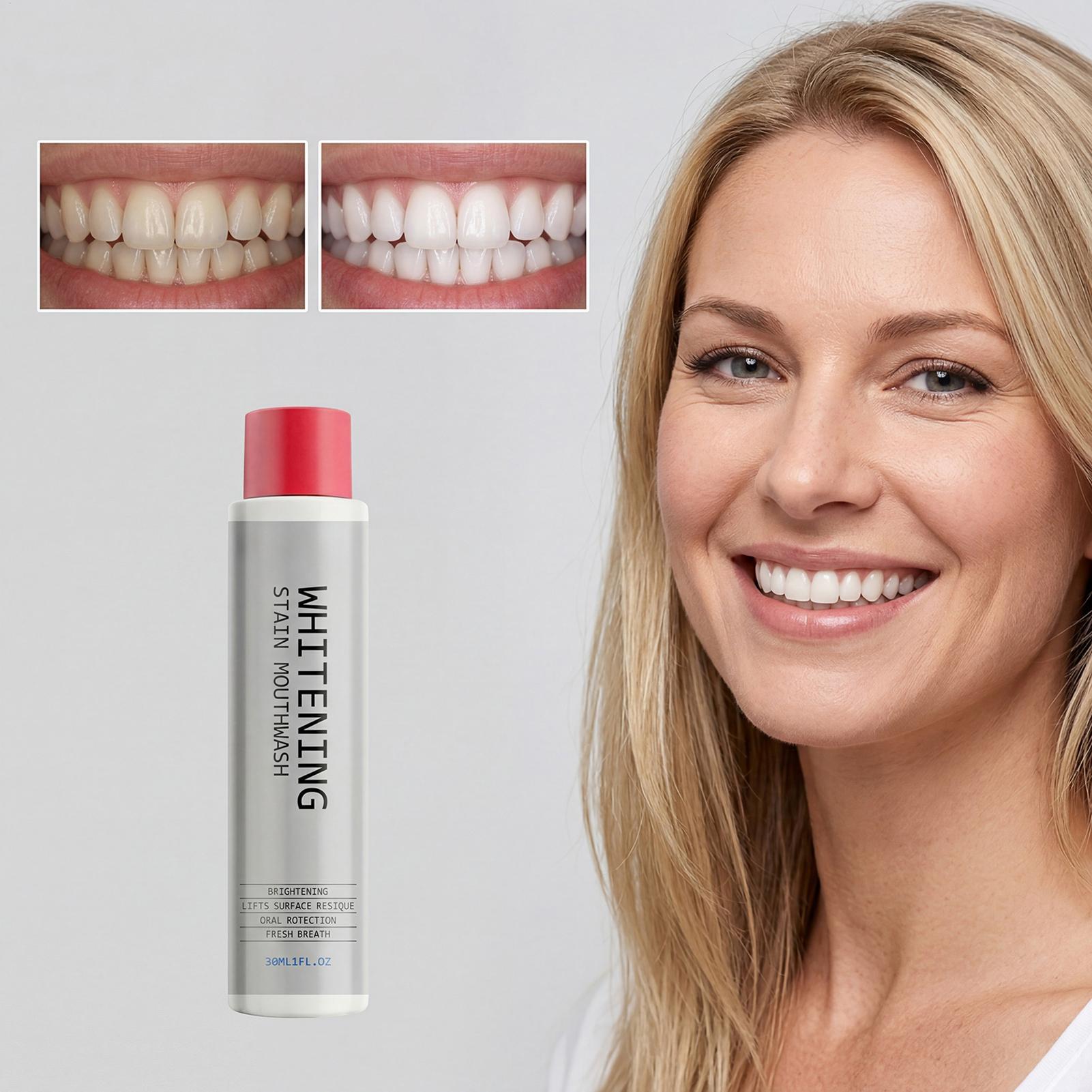غسول فم مبيض للبقع 30 مل، يزيل - مراجعة Teeth Whitening Mouthwash وسعره