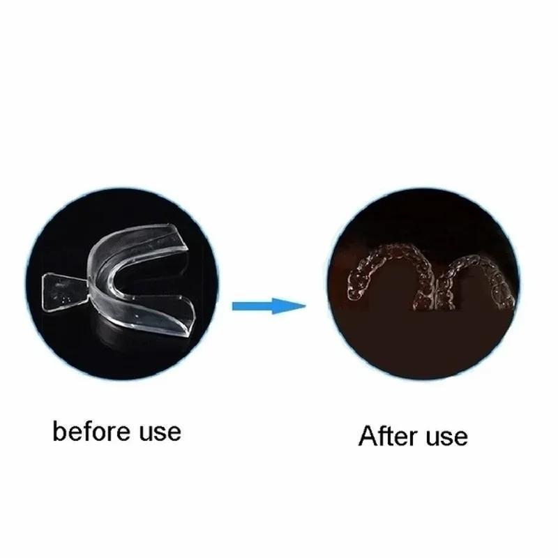 صينية تبييض أسنان احترافية، وا - مراجعة Teeth Whitening Kit At Home وسعره