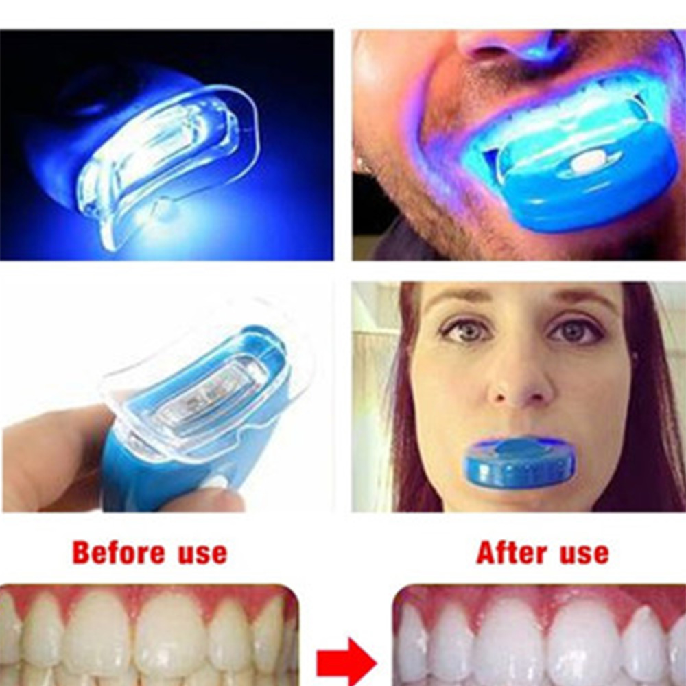 جديد الأزرق Led تبييض الأسنان  - مراجعة Teeth Whitening With Laser وسعره