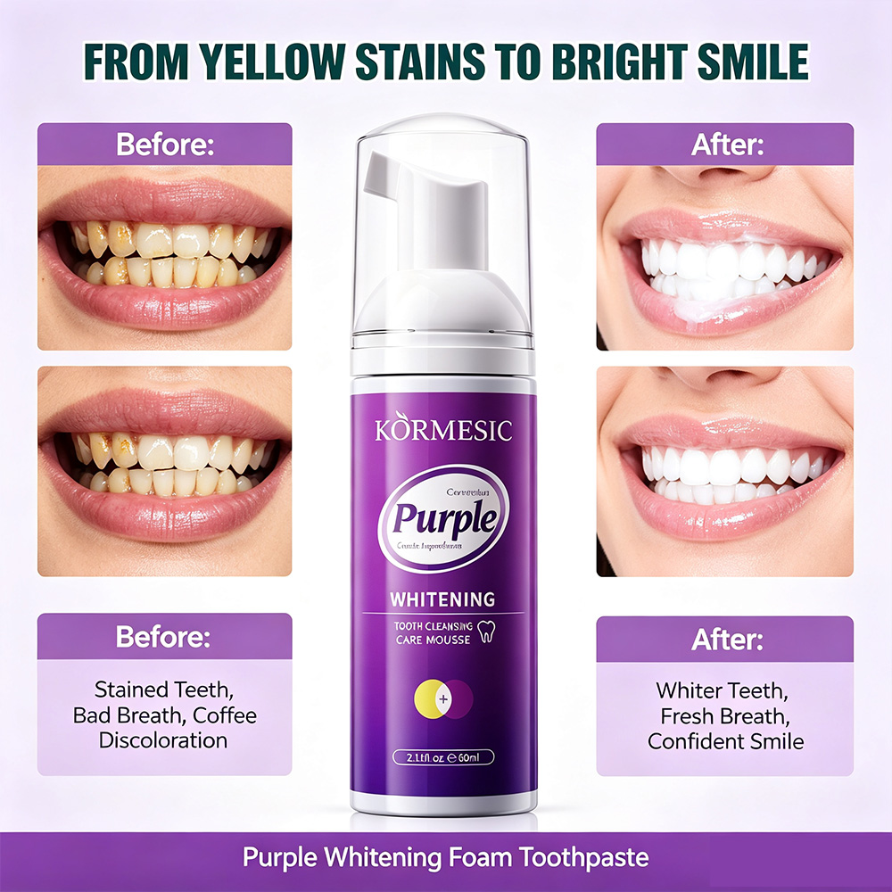 رغوة تبييض الأسنان البنفسجية V - مراجعة Teeth Whitening Crest وسعره