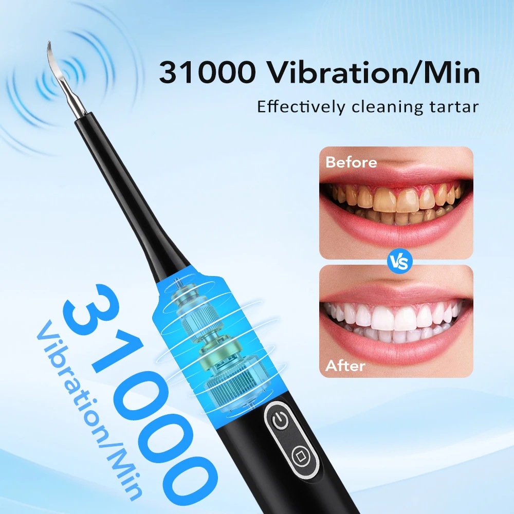 جهاز تنظيف الأسنان بالاهتزاز ا - مراجعة Teeth Whitening Mouthwash وسعره
